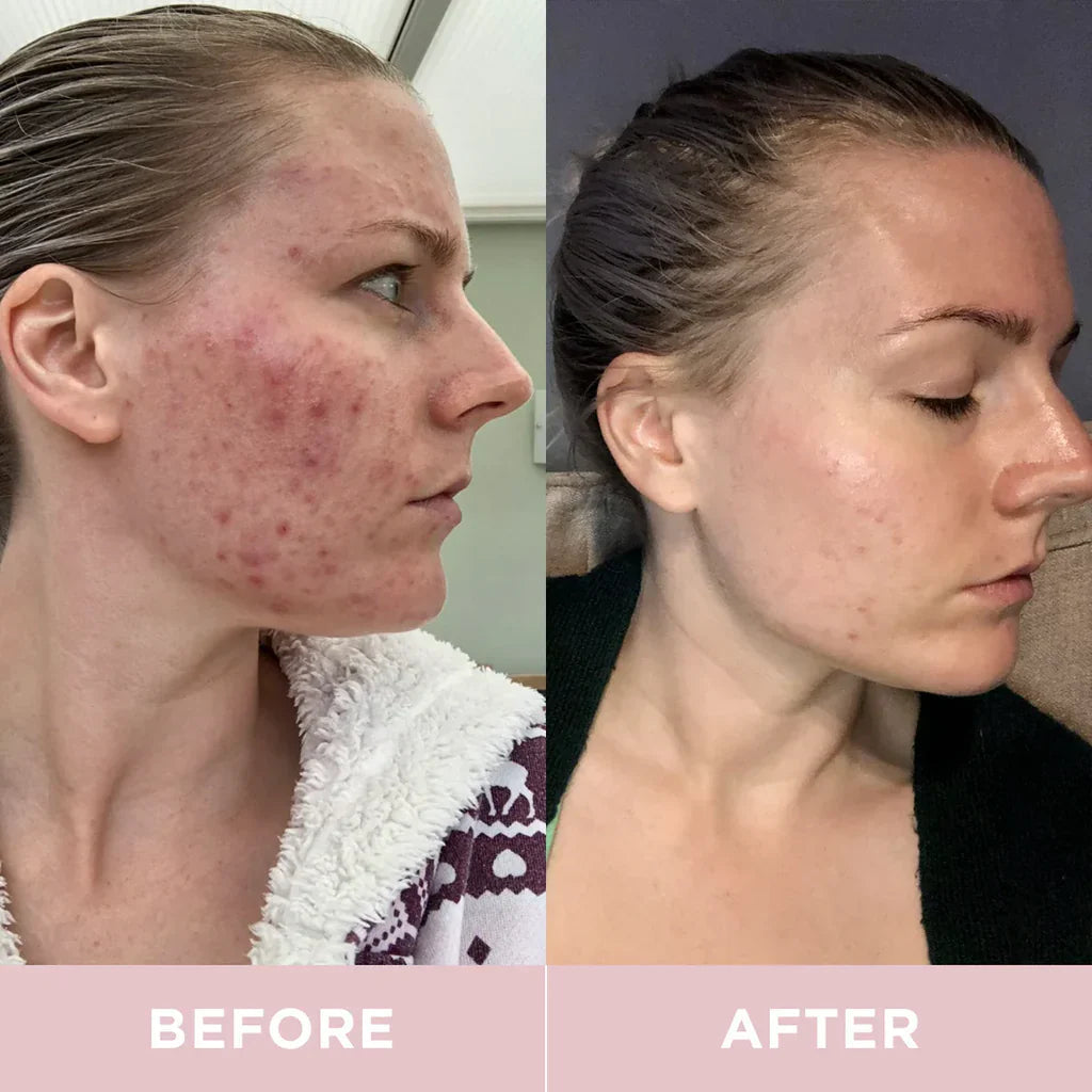 Revive Collagen Original - Hydrolyzed Marine Collagen Drink