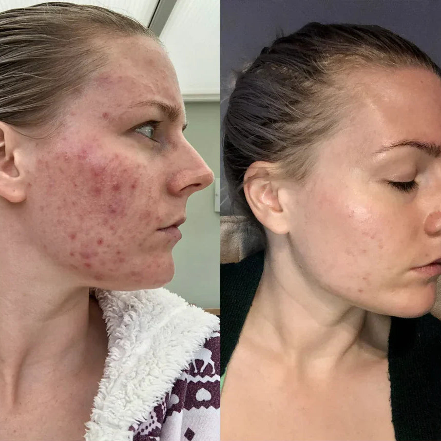 [USA] Revive Collagen Original - Hydrolyzed Marine Collagen Drink